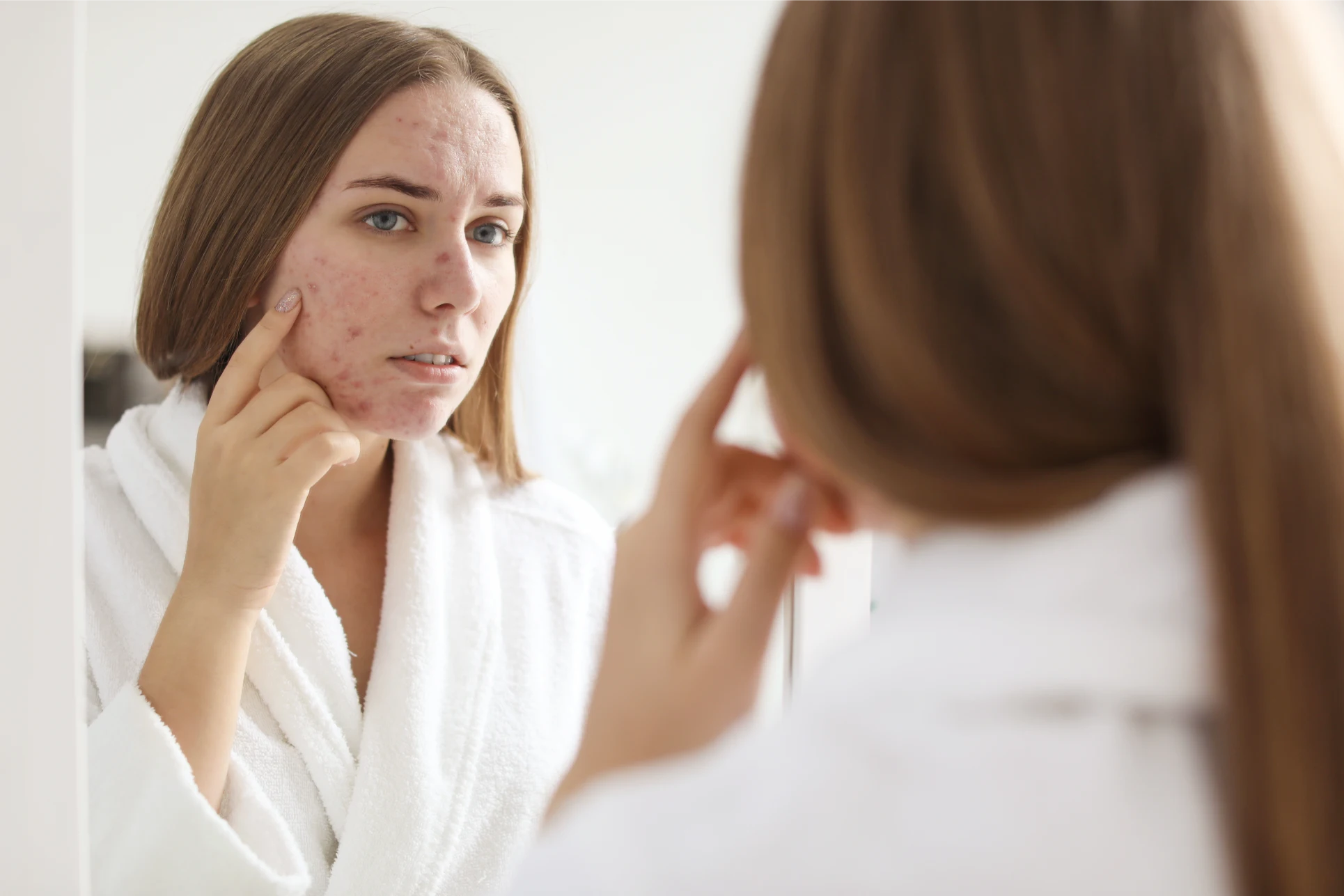Patient benefiting from non-invasive light-based acne therapy at Gold Skin Care Nashville TN